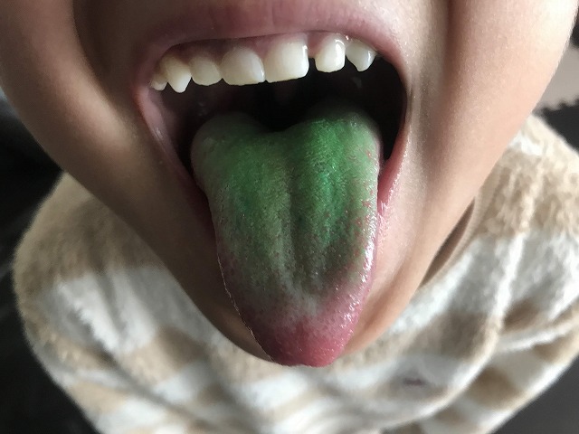 お菓子の色が付いた緑色の舌を出す子ども